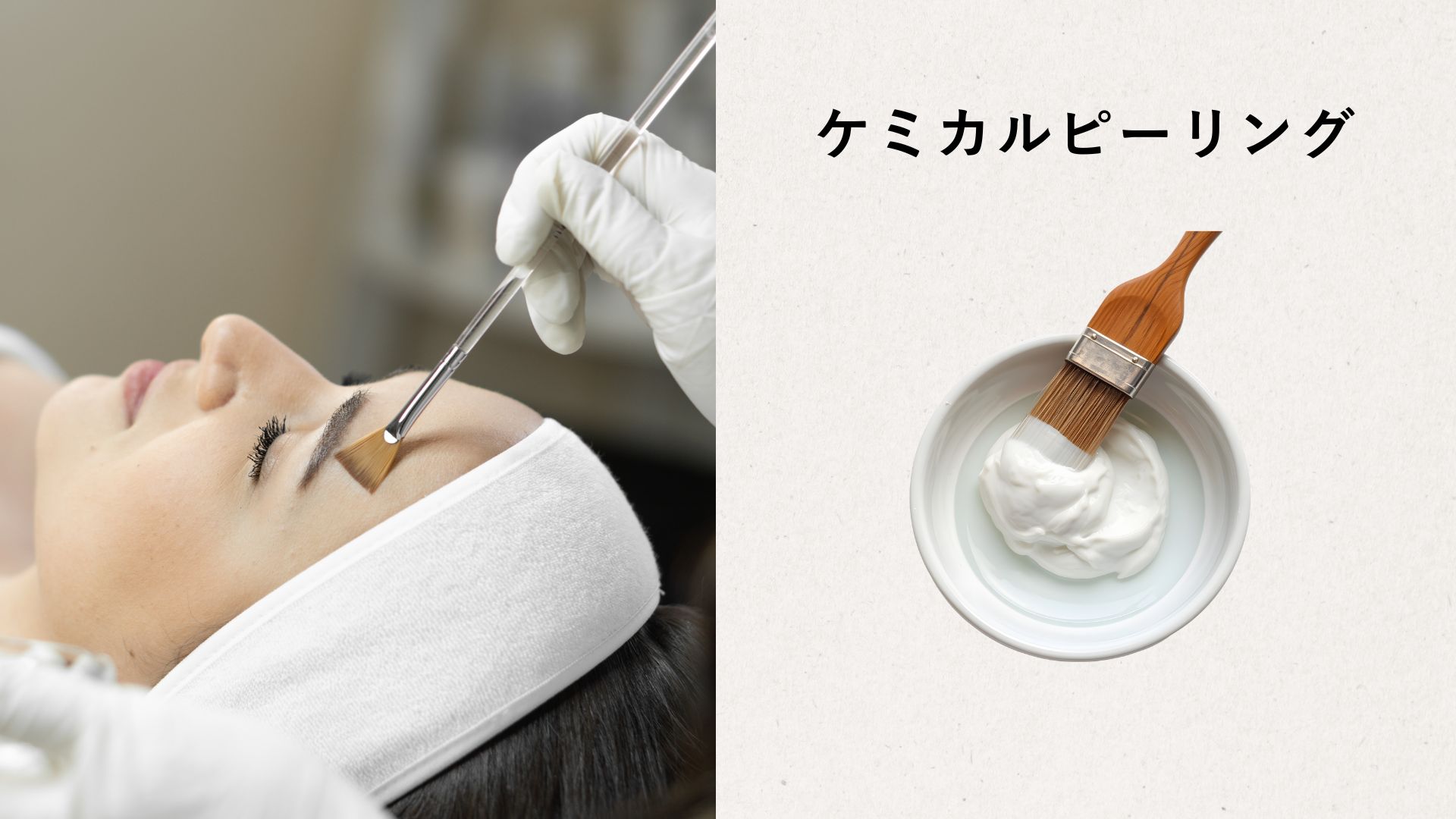 ケミカルピーリング