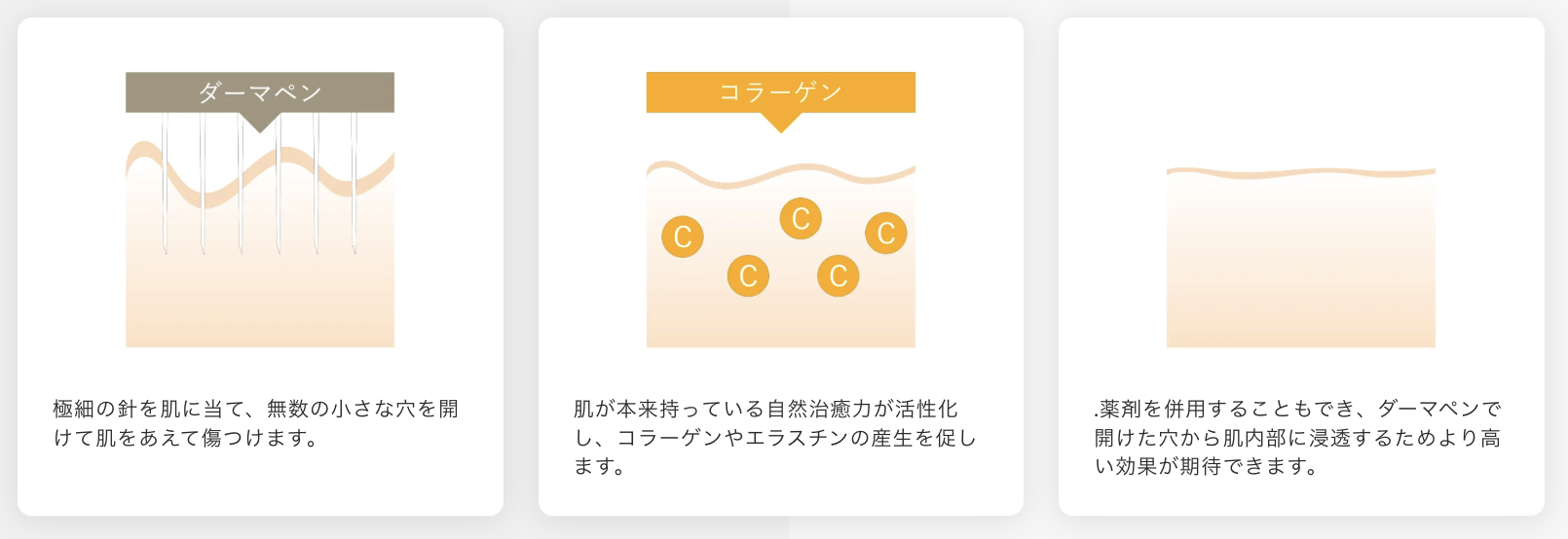 ダーマペン4について